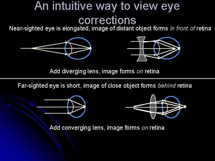 An intuitive way to view eye corrections Near-sighted eye is elongated, image of distant