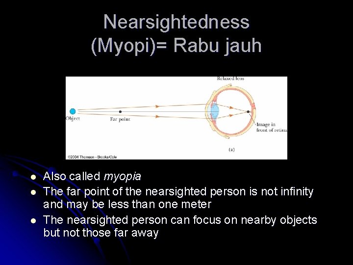 Nearsightedness (Myopi)= Rabu jauh l l l Also called myopia The far point of