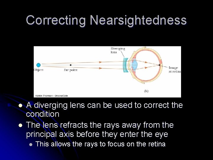 Correcting Nearsightedness l l A diverging lens can be used to correct the condition