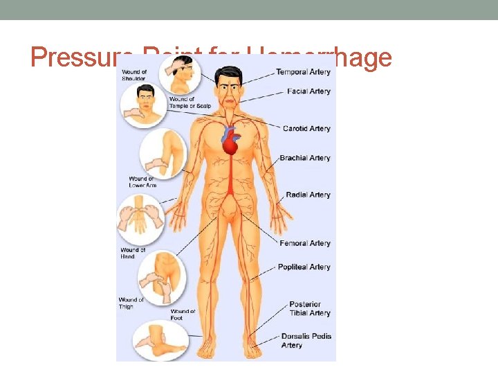 Pressure Point for Hemorrhage 