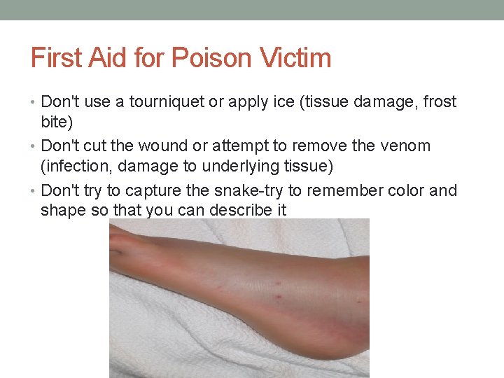 First Aid for Poison Victim • Don't use a tourniquet or apply ice (tissue