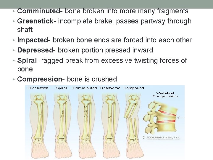  • Comminuted- bone broken into more many fragments • Greenstick- incomplete brake, passes