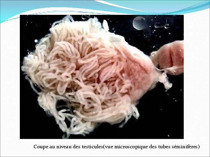 Coupe au niveau des testicules(vue microscopique des tubes séminifères) 