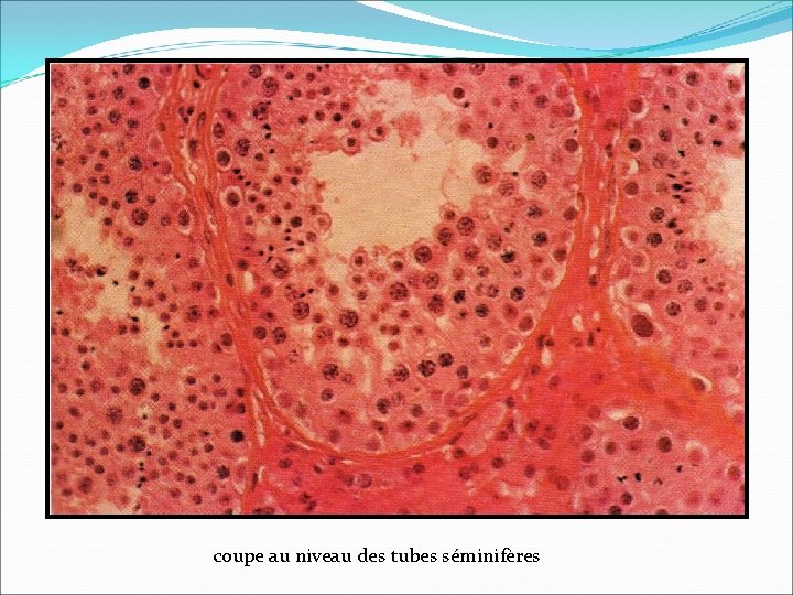 coupe au niveau des tubes séminifères 