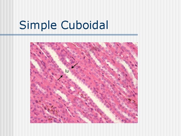 Simple Cuboidal 