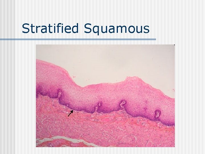 Stratified Squamous 