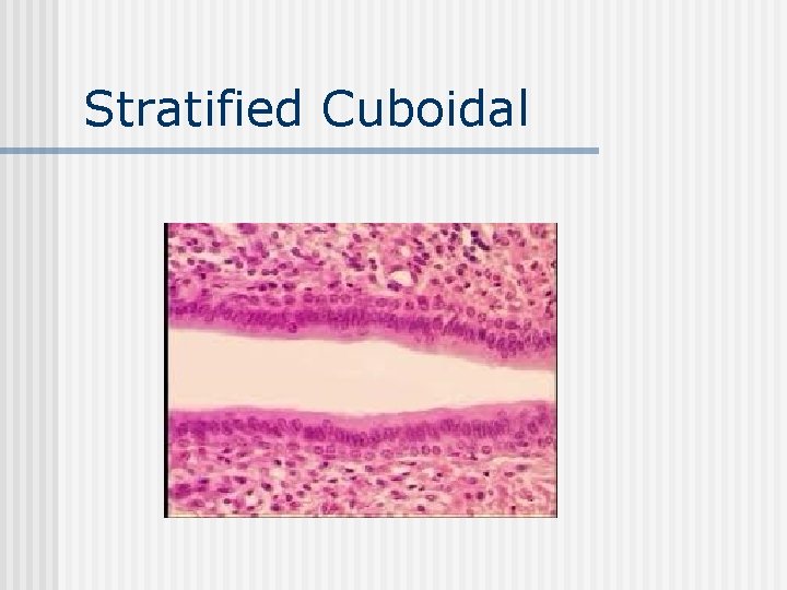 Stratified Cuboidal 