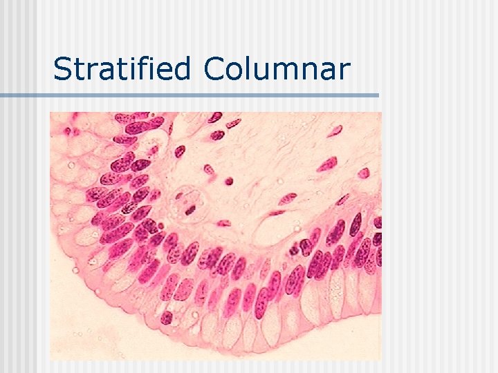 Stratified Columnar 
