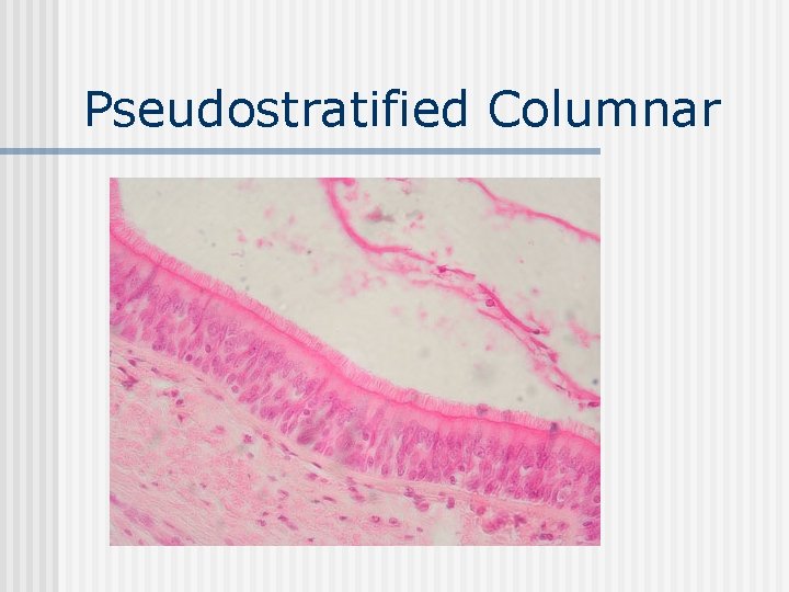 Pseudostratified Columnar 
