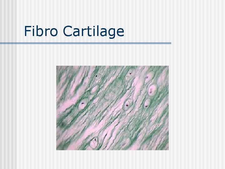 Fibro Cartilage 