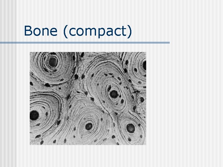 Bone (compact) 