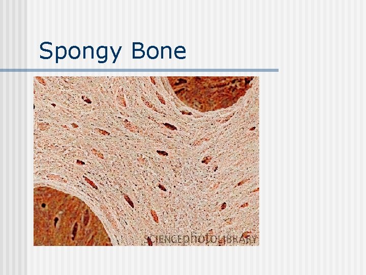 Spongy Bone 