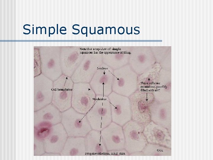 Simple Squamous 