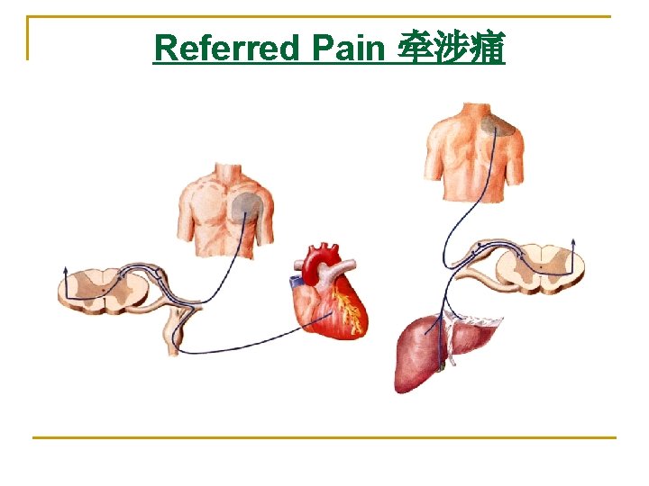 Referred Pain 牵涉痛 