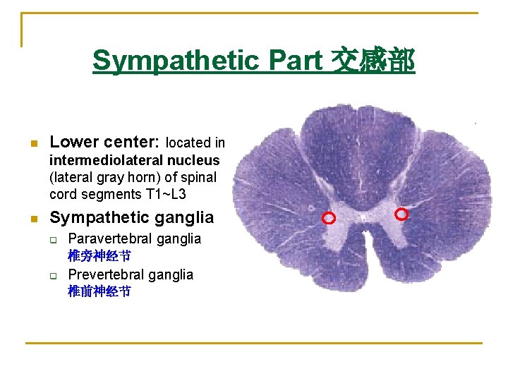 Sympathetic Part 交感部 n Lower center: located in intermediolateral nucleus (lateral gray horn) of