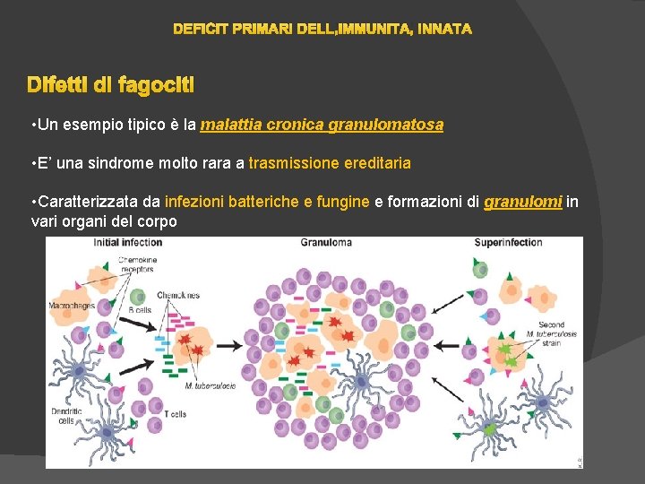 DEFICIT PRIMARI DELL’IMMUNITA’ INNATA Difetti di fagociti • Un esempio tipico è la malattia DEFICIT PRIMARI DELL’IMMUNITA’ INNATA Difetti di fagociti • Un esempio tipico è la malattia