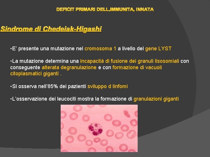 DEFICIT PRIMARI DELL’IMMUNITA’ INNATA Sindrome di Chedeiak-Higashi • E’ presente una mutazione nel cromosoma DEFICIT PRIMARI DELL’IMMUNITA’ INNATA Sindrome di Chedeiak-Higashi • E’ presente una mutazione nel cromosoma