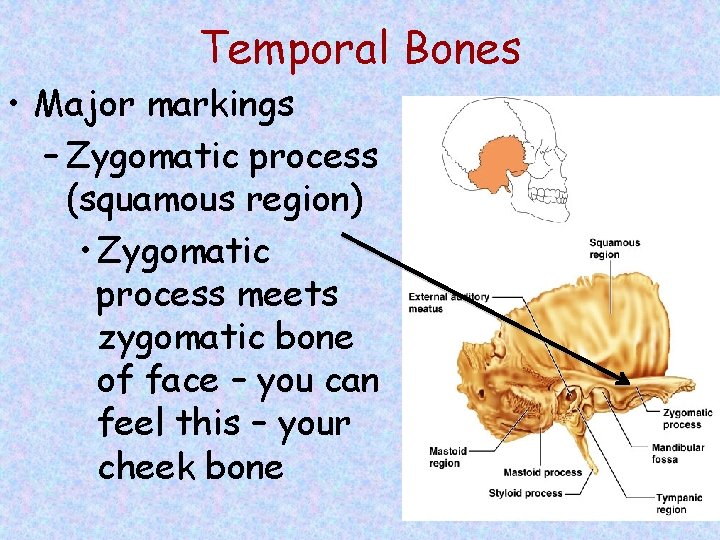 Temporal Bones • Major markings – Zygomatic process (squamous region) • Zygomatic process meets