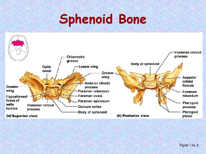 Sphenoid Bone Figure 7. 6 a, b 