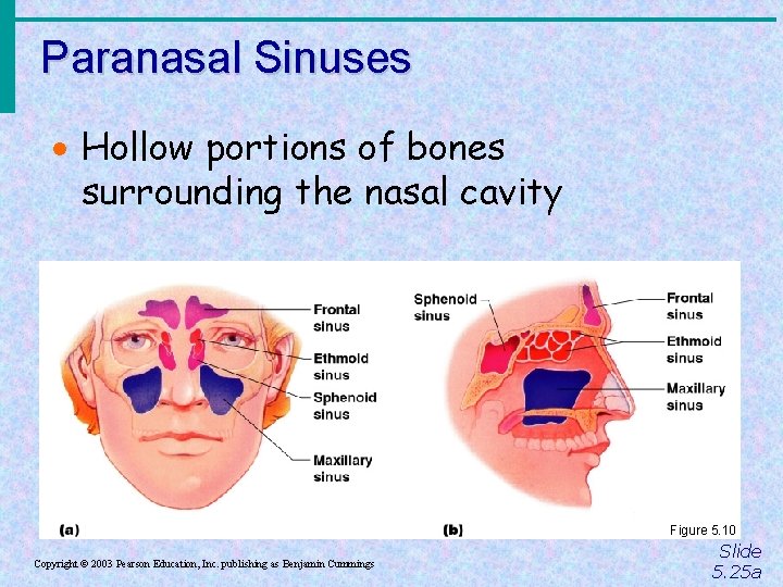 Paranasal Sinuses · Hollow portions of bones surrounding the nasal cavity Figure 5. 10