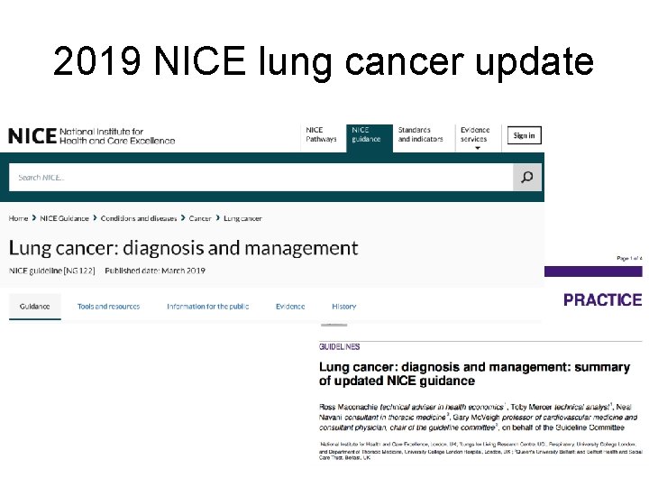 2019 NICE lung cancer update 