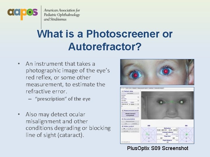 What is a Photoscreener or Autorefractor? • An instrument that takes a photographic image