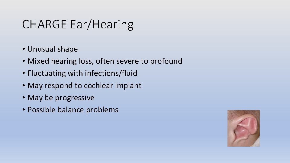 CHARGE Ear/Hearing • Unusual shape • Mixed hearing loss, often severe to profound •