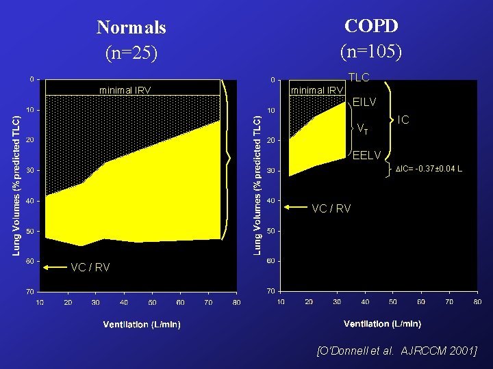 Normals (n=25) COPD (n=105) TLC minimal IRV EILV VT IC EELV IC= -0. 37± Normals (n=25) COPD (n=105) TLC minimal IRV EILV VT IC EELV IC= -0. 37±