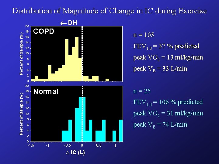 Distribution of Magnitude of Change in IC during Exercise DH COPD n = 105 Distribution of Magnitude of Change in IC during Exercise DH COPD n = 105