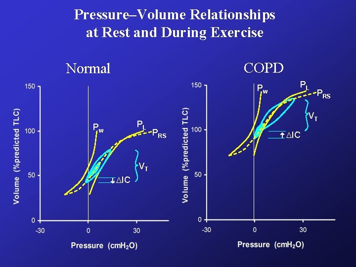 Pressure–Volume Relationships at Rest and During Exercise COPD Normal PL Pw VT IC PRS Pressure–Volume Relationships at Rest and During Exercise COPD Normal PL Pw VT IC PRS