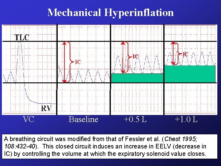 Mechanical Hyperinflation VC Baseline +0. 5 L +1. 0 L A breathing circuit was Mechanical Hyperinflation VC Baseline +0. 5 L +1. 0 L A breathing circuit was