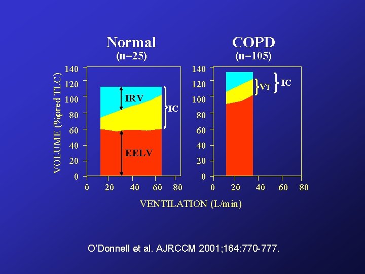 Normal COPD VOLUME (%pred TLC) (n=25) (n=105) 140 120 IRV 100 IC 80 60 Normal COPD VOLUME (%pred TLC) (n=25) (n=105) 140 120 IRV 100 IC 80 60
