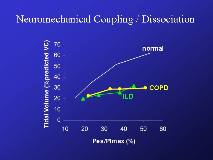 Neuromechanical Coupling / Dissociation normal COPD ILD Neuromechanical Coupling / Dissociation normal COPD ILD