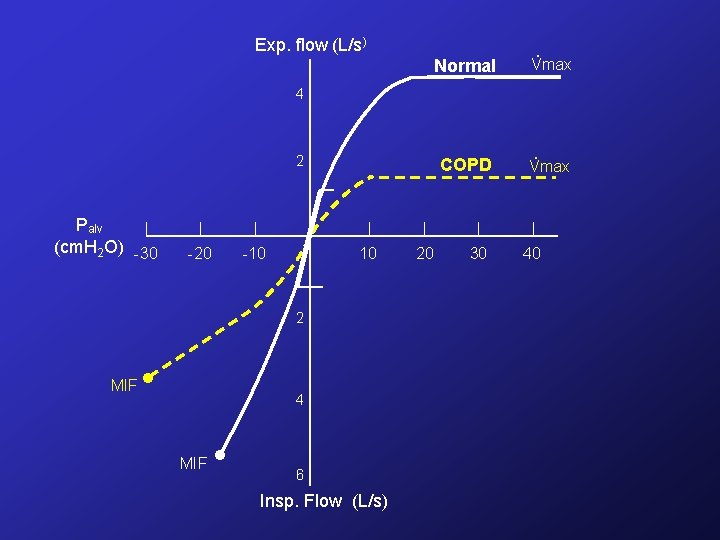 Exp. flow (L/s) . Normal Vmax COPD . Vmax 4 2 Palv (cm. H Exp. flow (L/s) . Normal Vmax COPD . Vmax 4 2 Palv (cm. H