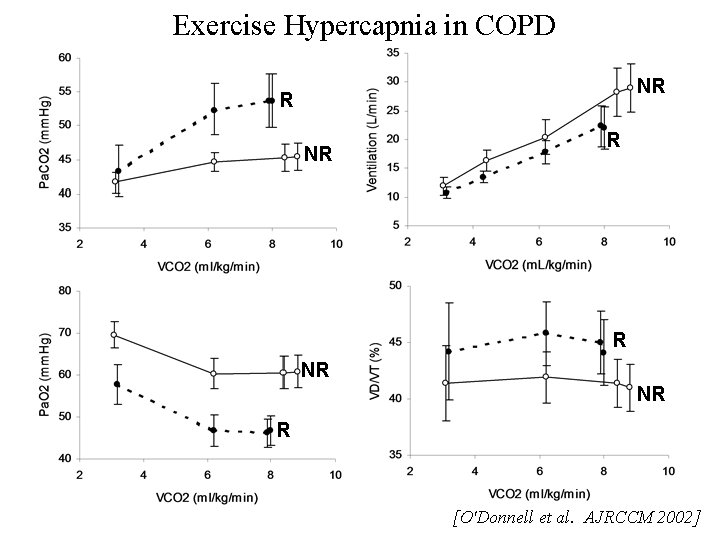 Exercise Hypercapnia in COPD NR R R NR NR R [O'Donnell et al. AJRCCM Exercise Hypercapnia in COPD NR R R NR NR R [O'Donnell et al. AJRCCM