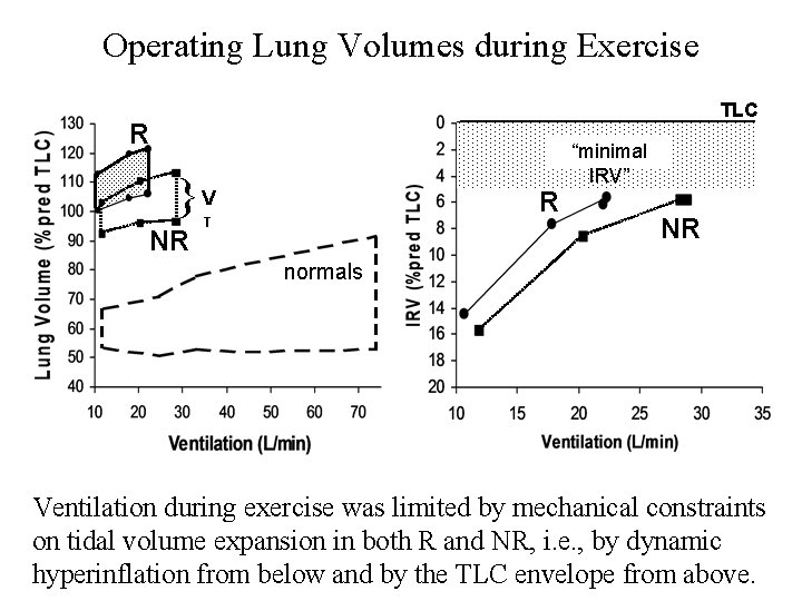 Operating Lung Volumes during Exercise TLC R }V NR R T “minimal IRV” NR Operating Lung Volumes during Exercise TLC R }V NR R T “minimal IRV” NR