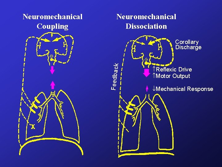 Neuromechanical Dissociation Corollary Discharge Feedback Neuromechanical Coupling Reflexic Drive Motor Output Mechanical Response Neuromechanical Dissociation Corollary Discharge Feedback Neuromechanical Coupling Reflexic Drive Motor Output Mechanical Response