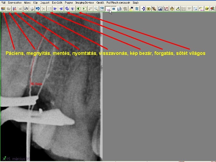 Páciens, megnyitás, mentés, nyomtatás, visszavonás, kép bezár, forgatás, sötét világos 2015. március 31. 