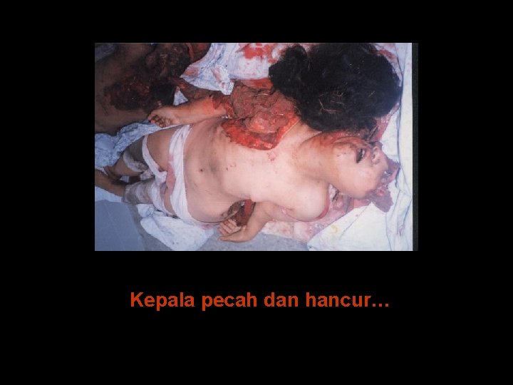 Kepala pecah dan hancur… 