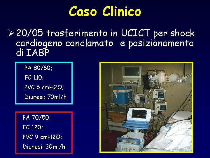 Caso Clinico Ø 20/05 trasferimento in UCICT per shock cardiogeno conclamato e posizionamento di