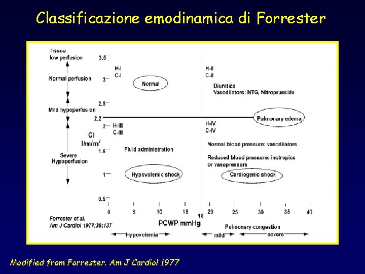 Classificazione emodinamica di Forrester Modified from Forrester. Am J Cardiol 1977 