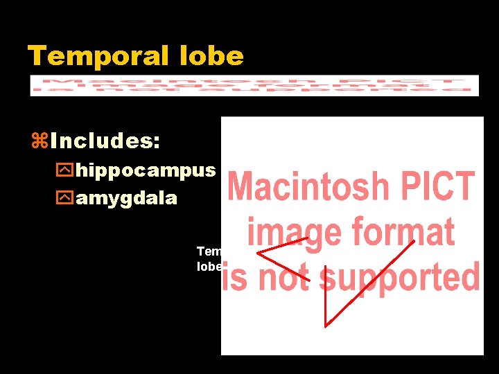 Temporal lobe z. Includes: yhippocampus yamygdala Temporal lobe Hippocampus 