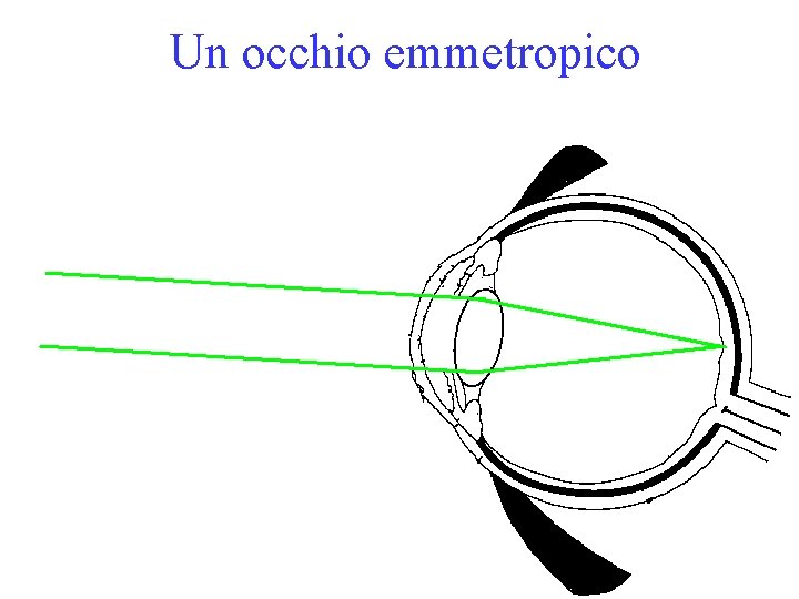 Un occhio emmetropico 