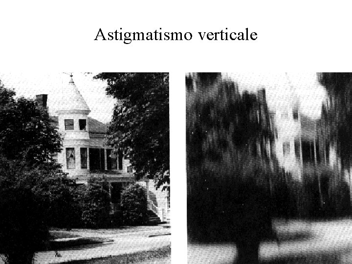 Astigmatismo verticale 
