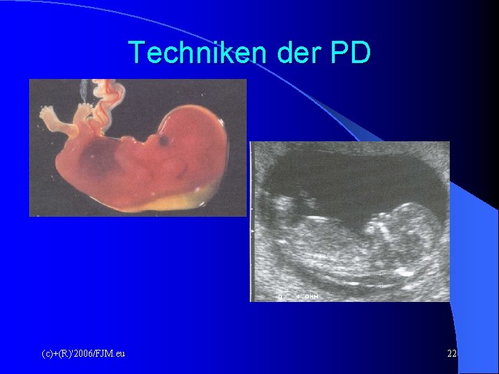 Techniken der PD (c)+(R)'2006/FJM. eu 22 