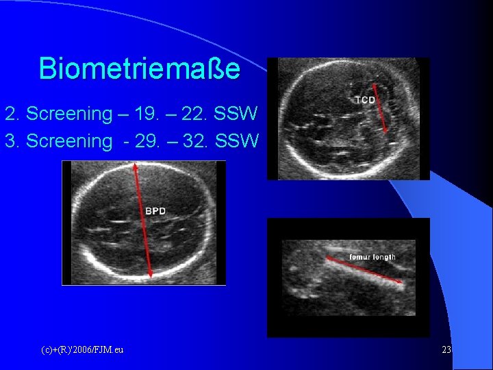 Biometriemaße 2. Screening – 19. – 22. SSW 3. Screening - 29. – 32.