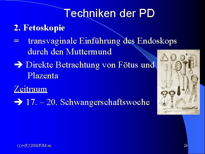 Techniken der PD 2. Fetoskopie = transvaginale Einführung des Endoskops durch den Muttermund Direkte Techniken der PD 2. Fetoskopie = transvaginale Einführung des Endoskops durch den Muttermund Direkte