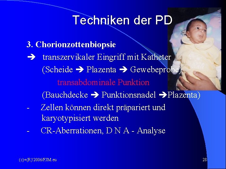 Techniken der PD 3. Chorionzottenbiopsie transzervikaler Eingriff mit Katheter (Scheide Plazenta Gewebeprobe) transabdominale Punktion Techniken der PD 3. Chorionzottenbiopsie transzervikaler Eingriff mit Katheter (Scheide Plazenta Gewebeprobe) transabdominale Punktion