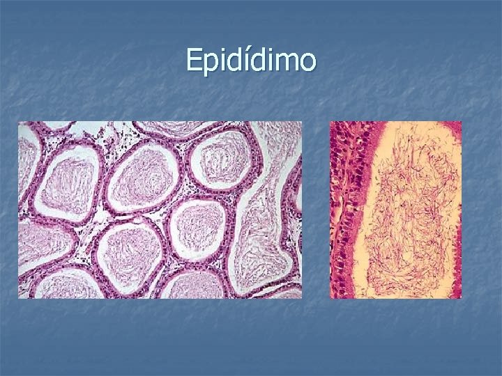 Epidídimo 