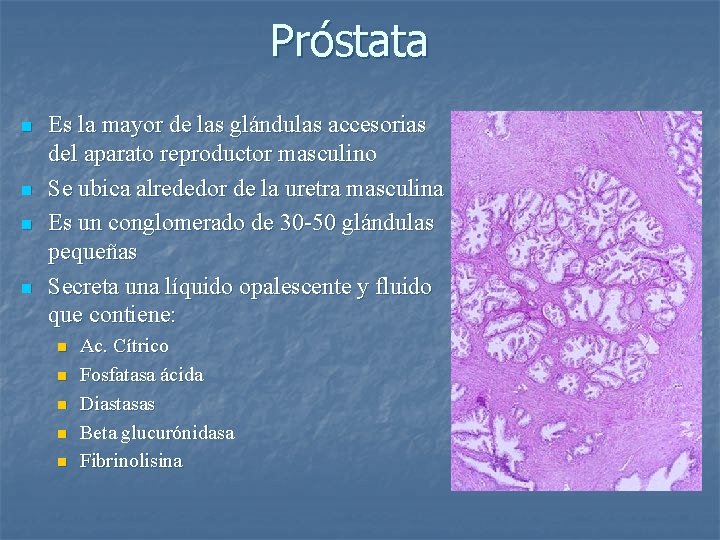 Próstata n n Es la mayor de las glándulas accesorias del aparato reproductor masculino